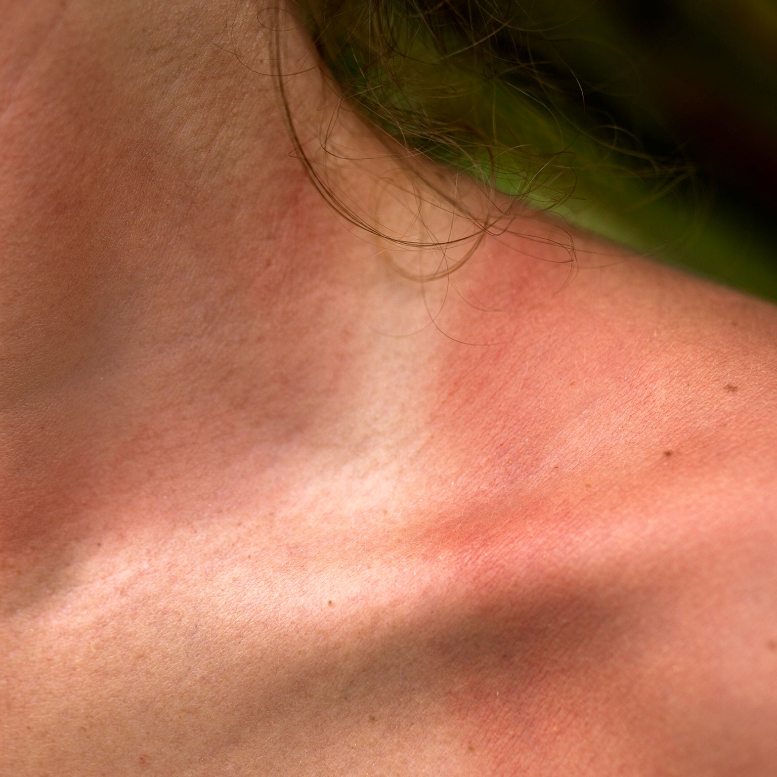 Why Tans Go Patchy (And How to Keep Your Glow Even)