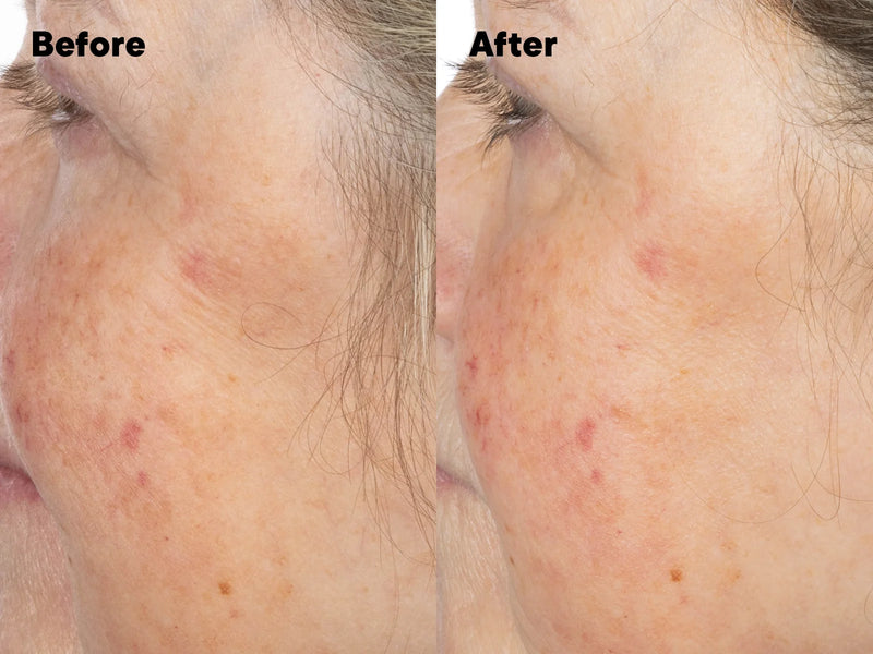 Premium Tanning Solutions