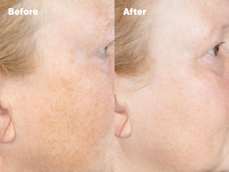 Australian Tanning Products