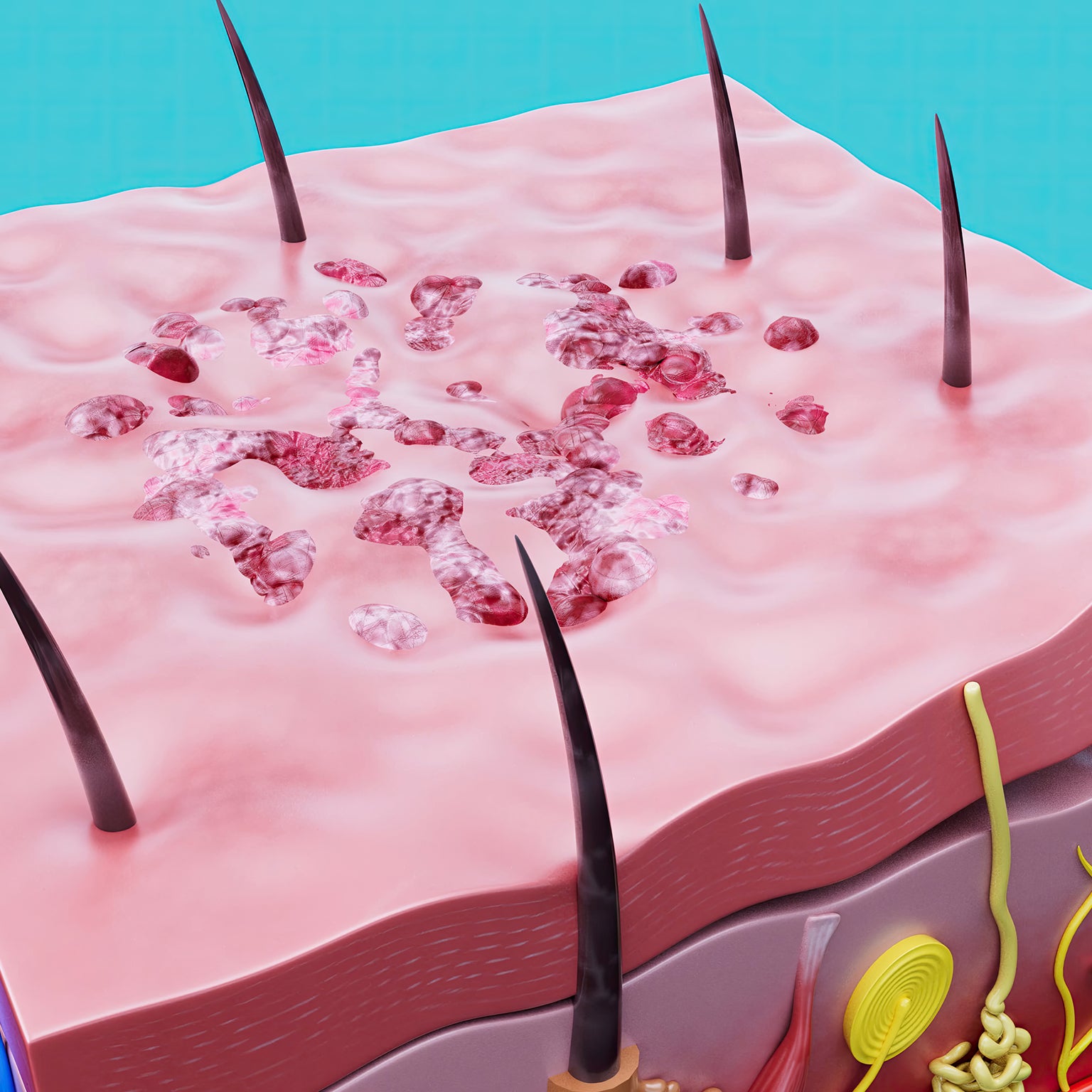 Skin barrier diagram showing healthy hydration layers